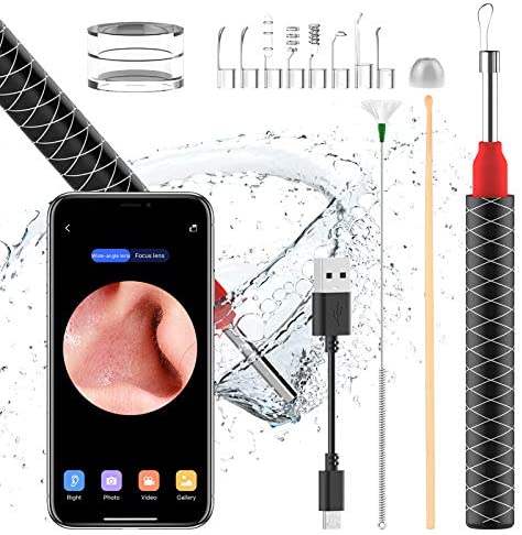 Gebalage Ear Wax Removal, Earwax Remover Tools With 3.5mm Lens,1080 FHD Camera Wireless Ear Wax Otoscope with 6 Super LED...